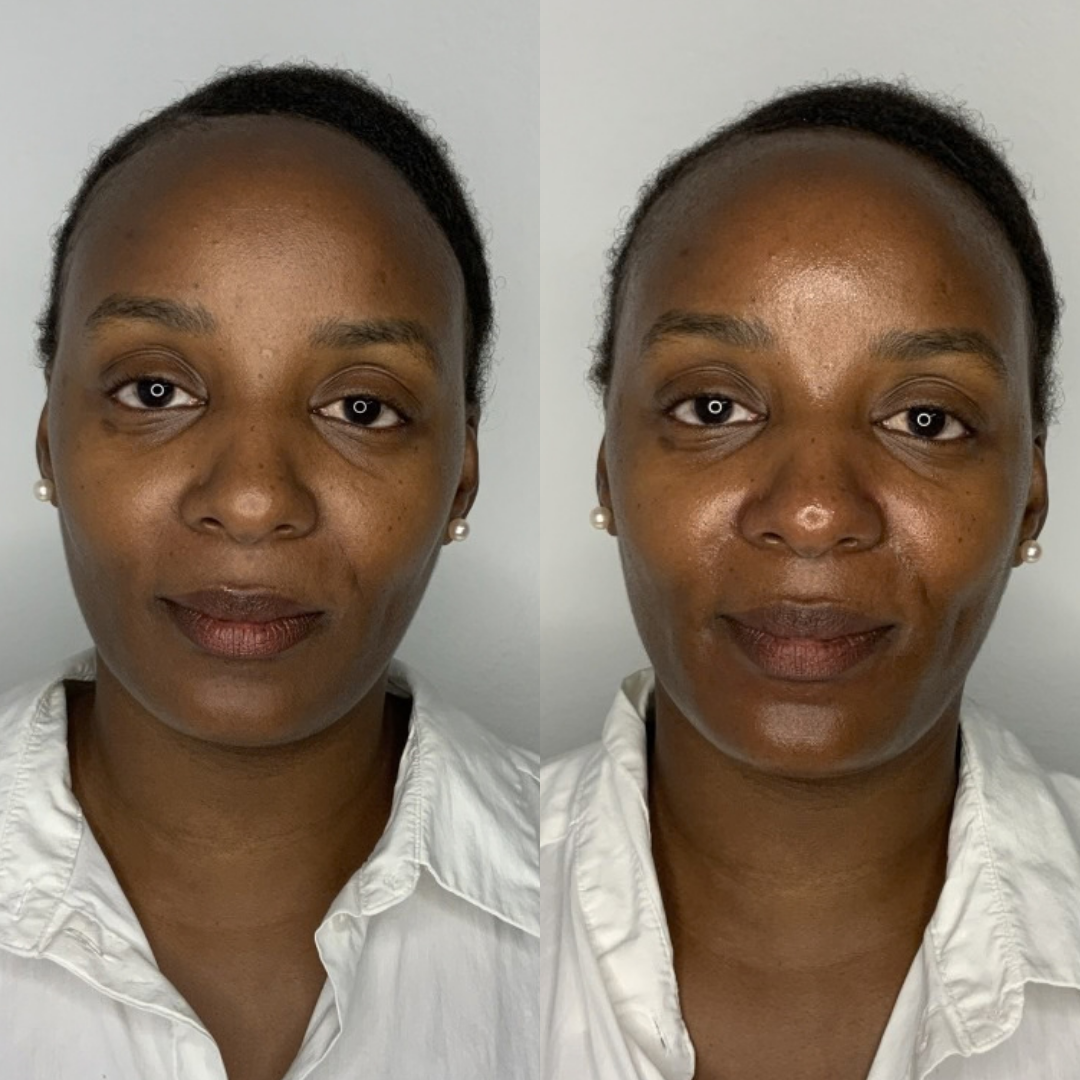 Glass Skin Facial – før og efter, eksempel 1
