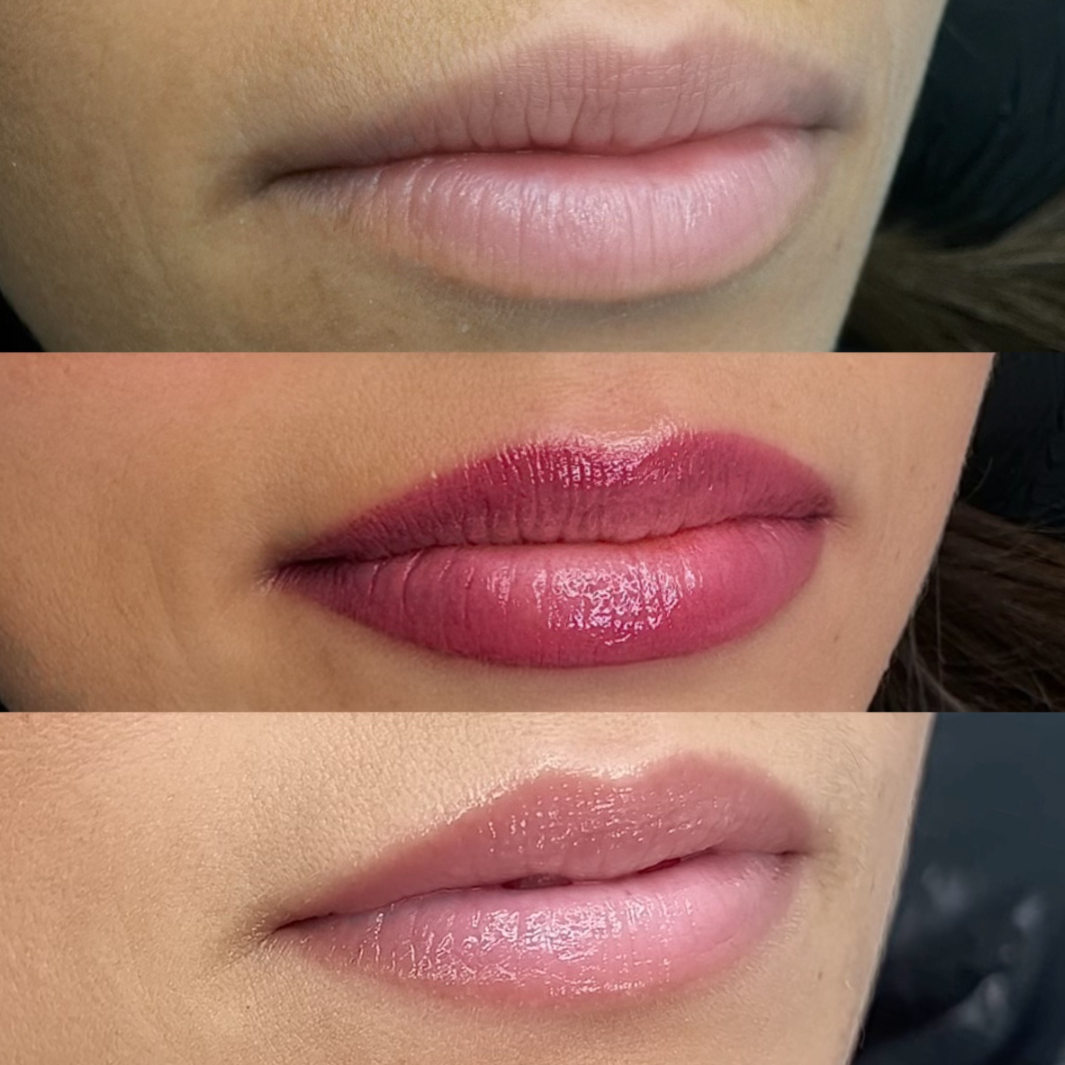 Permanent makeup - læber – før og efter, eksempel 1
