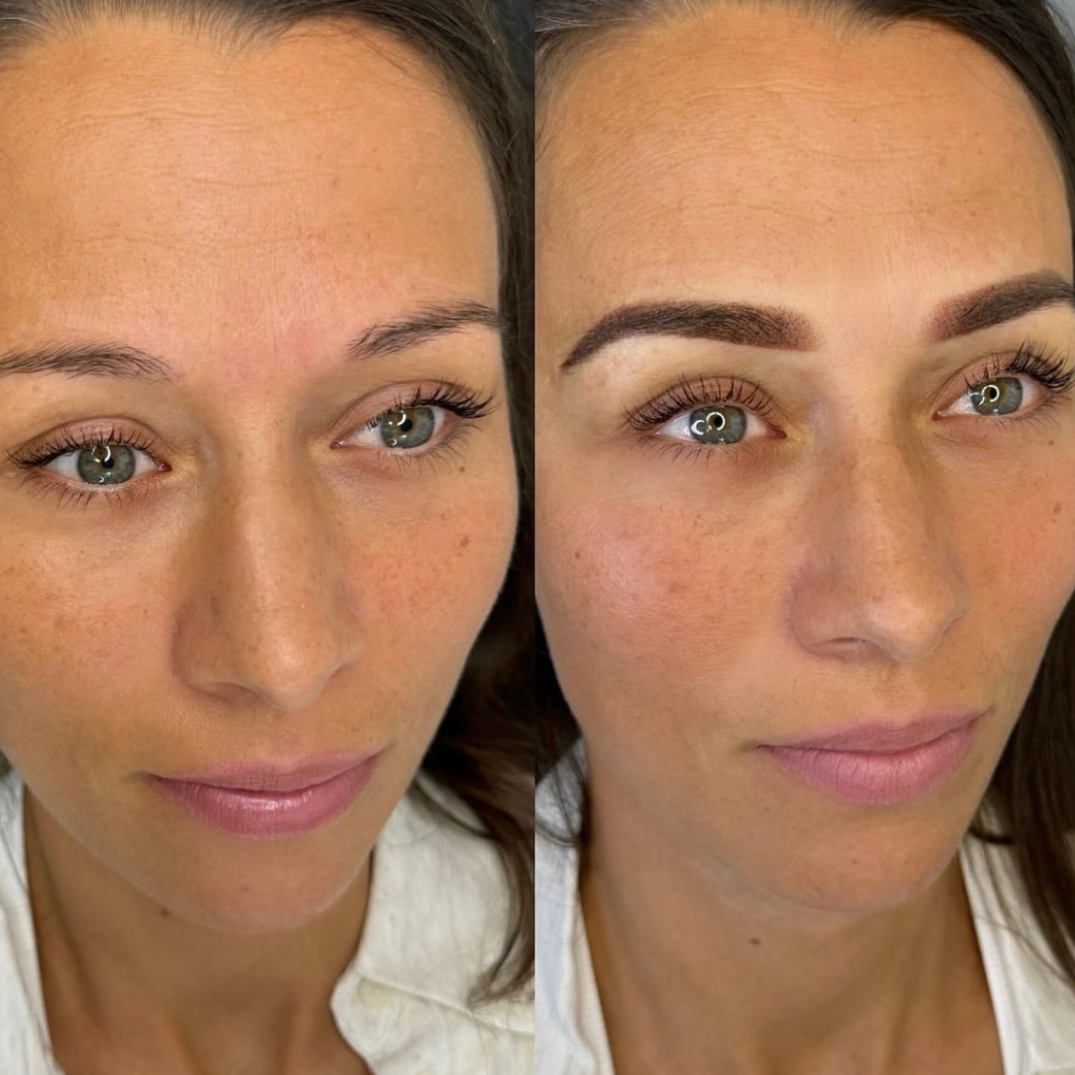 Permanent makeup - bryn – før og efter, eksempel 6