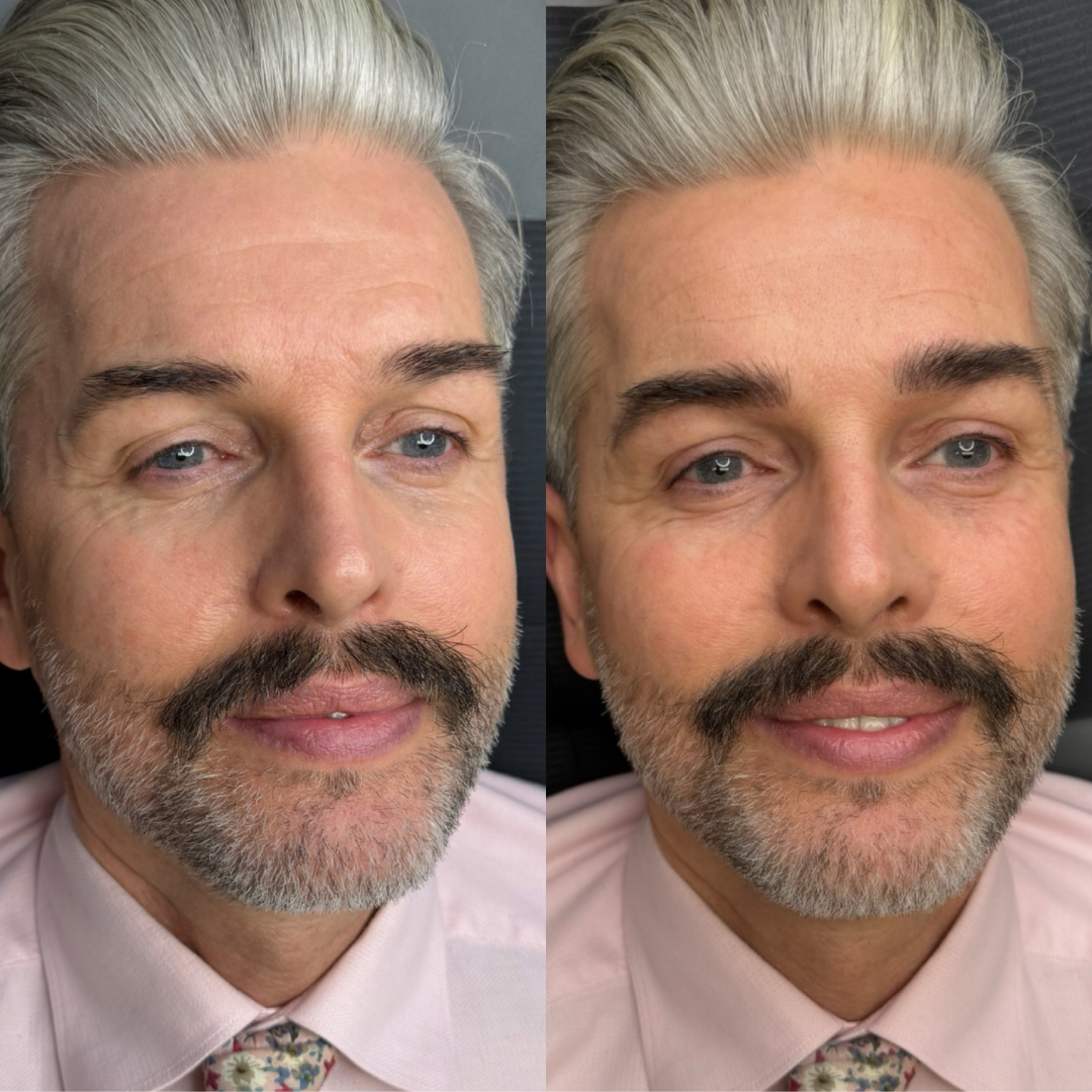Permanent makeup - bryn – før og efter, eksempel 4