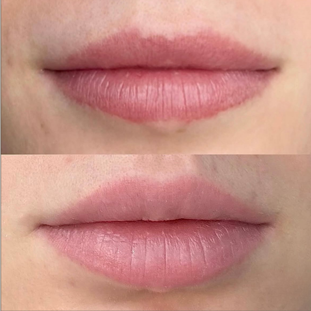 Permanent makeup - læber – før og efter, eksempel 4