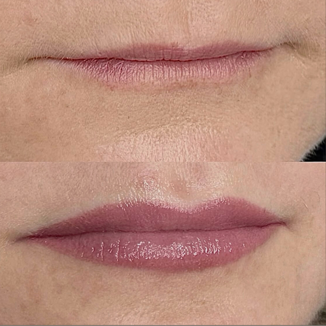 Permanent makeup - læber – før og efter, eksempel 5