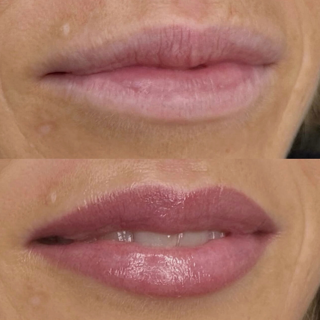 Permanent makeup - læber – før og efter, eksempel 1