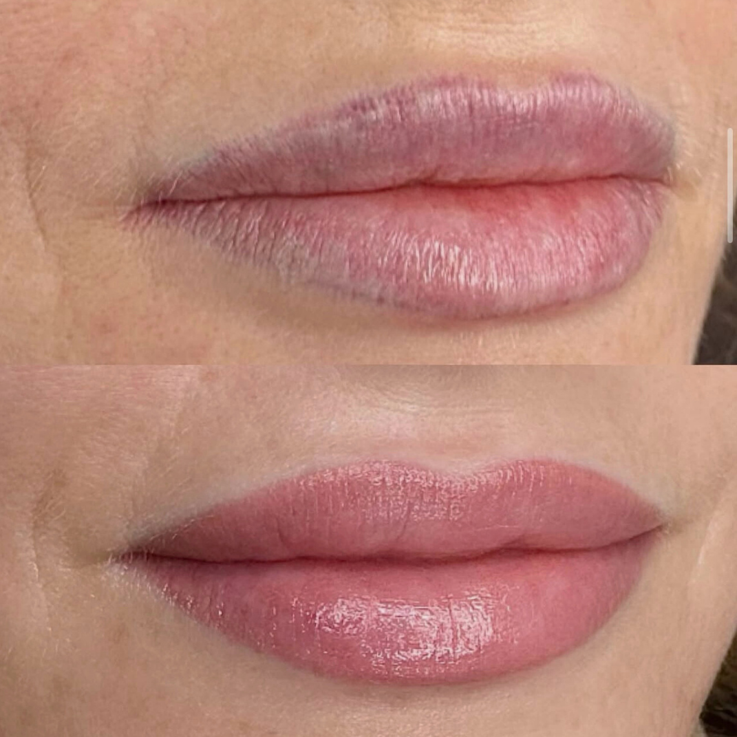 Permanent makeup - læber – før og efter, eksempel 2