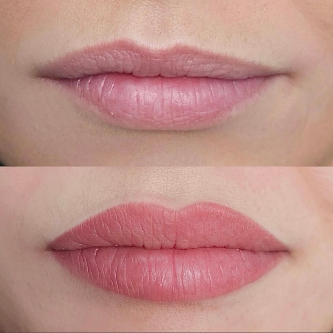 Permanent makeup - læber – før og efter, eksempel 3