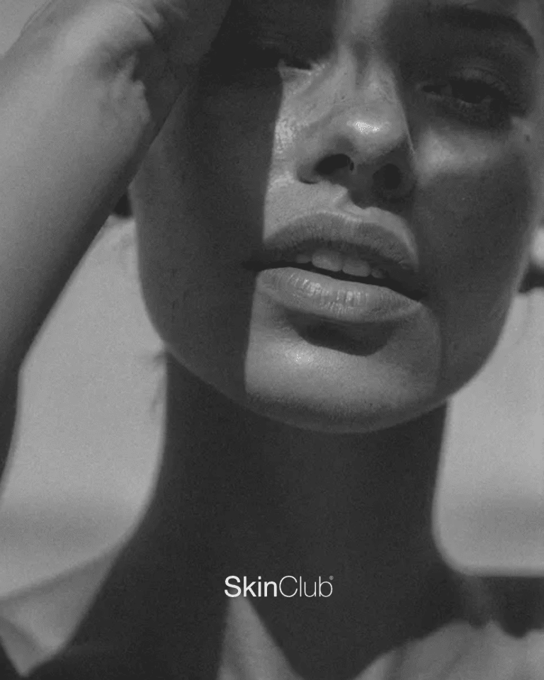 PRF microneedling Kolding København SkinClub Kosmetisk klinik