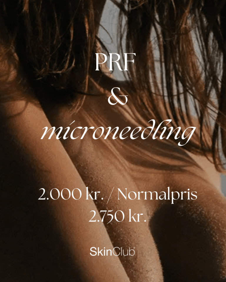 PRF microneedling Kolding København SkinClub Kosmetisk klinik