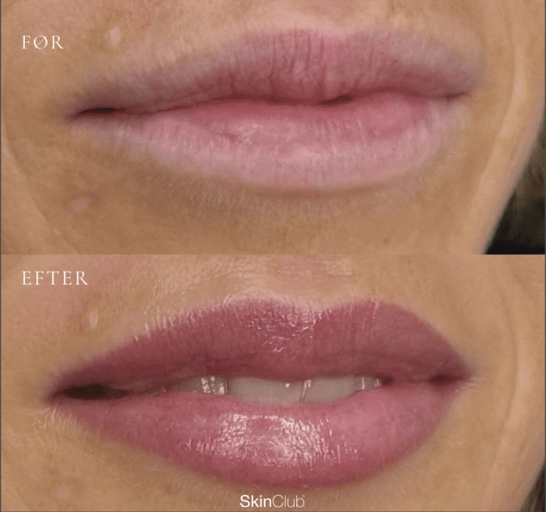permanent makeup læber Kolding københavn skinclub